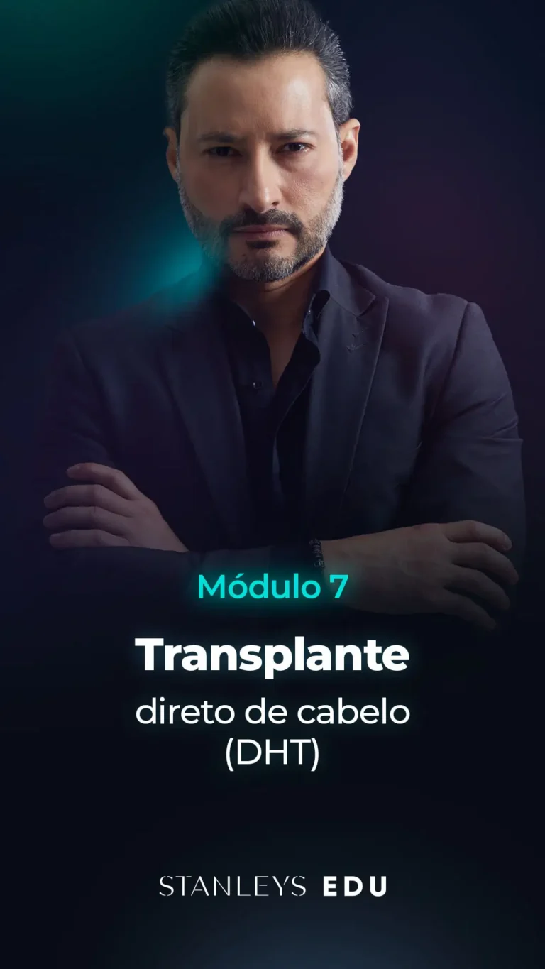 Transplante direto de cabelo DHT