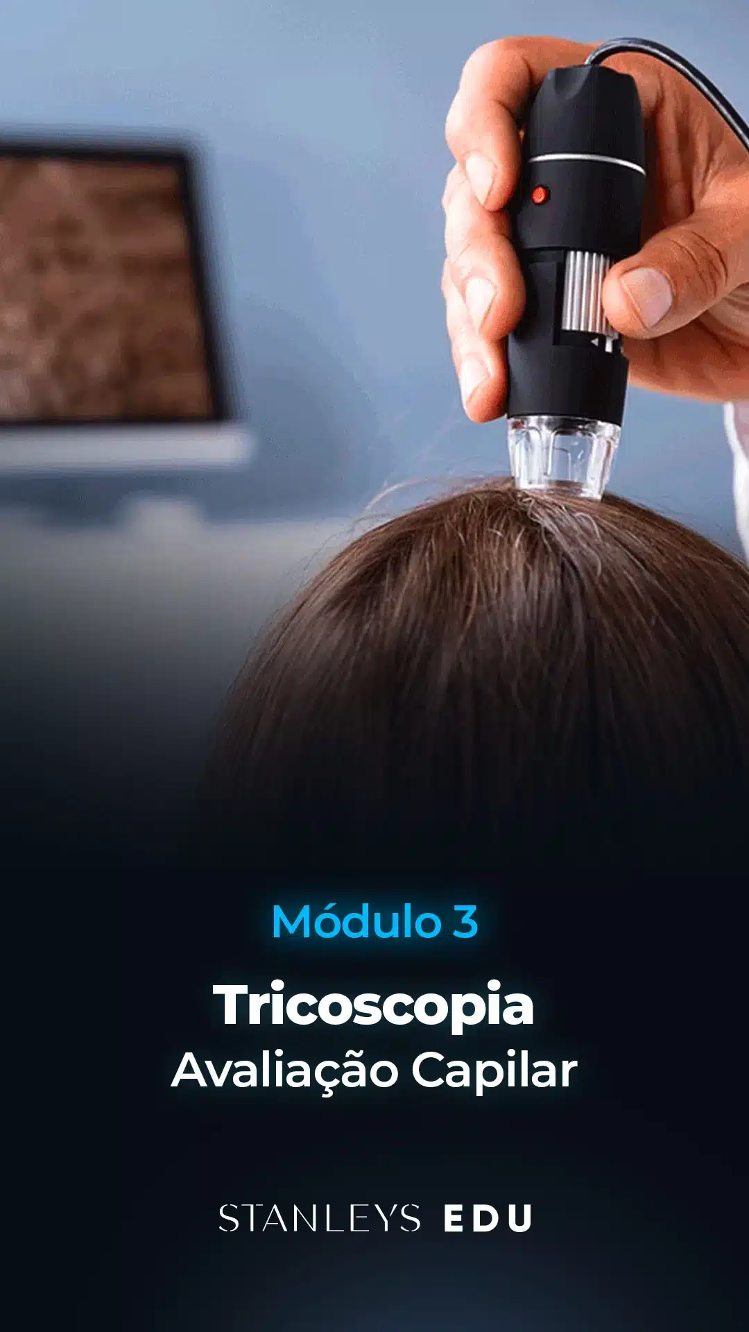 Modulo-3-Tricoscopia